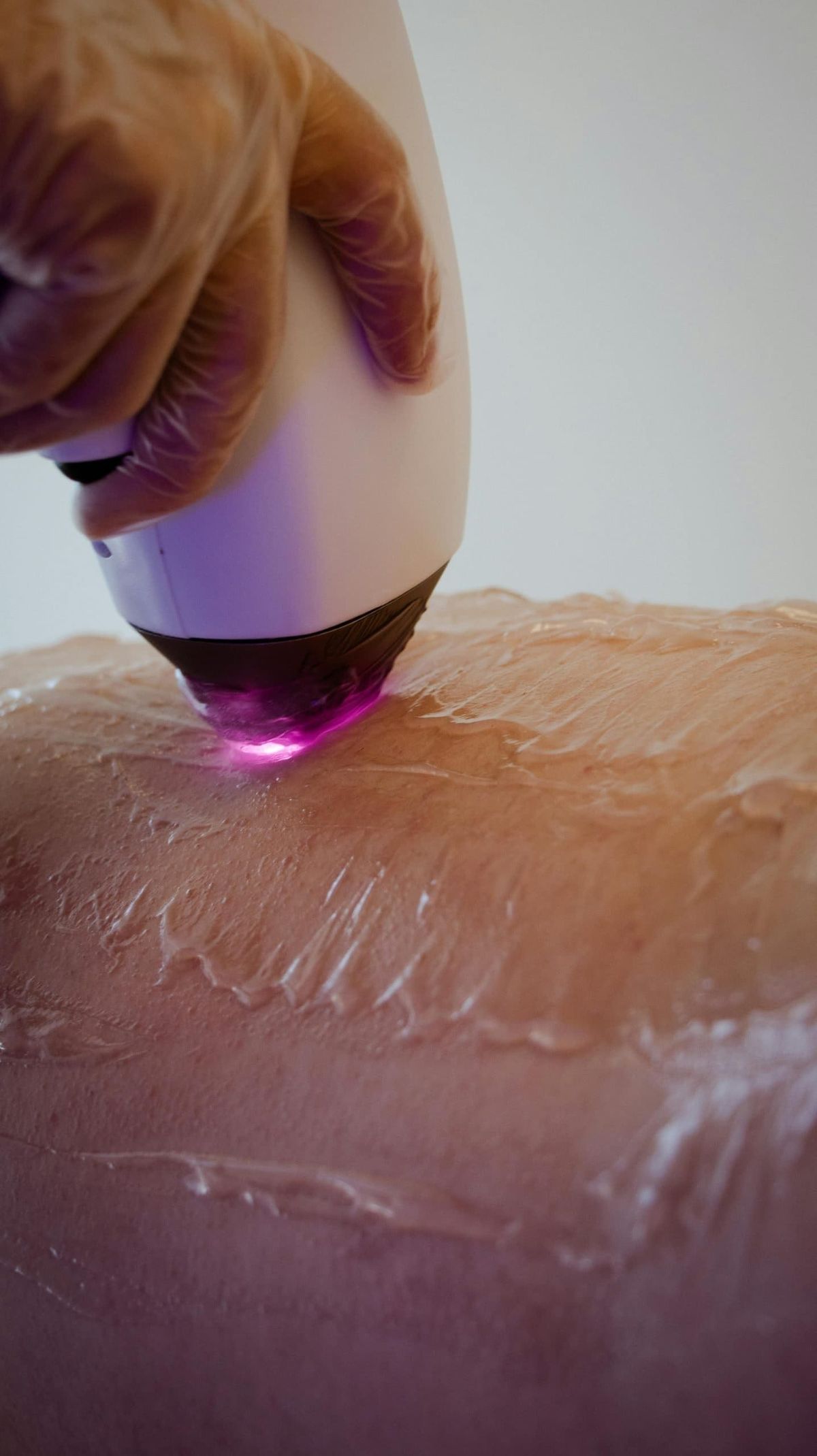 Equipamento de radiofrequência corporal em detalhe sobre bancada clínica, iluminação suave, paleta neutra